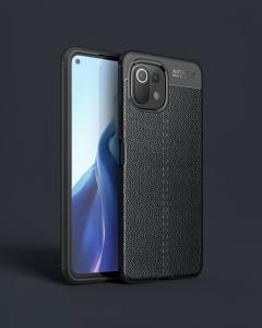 Xiaomi Mi 11 Lite Kılıf Auto Focus Kapak - Siyah